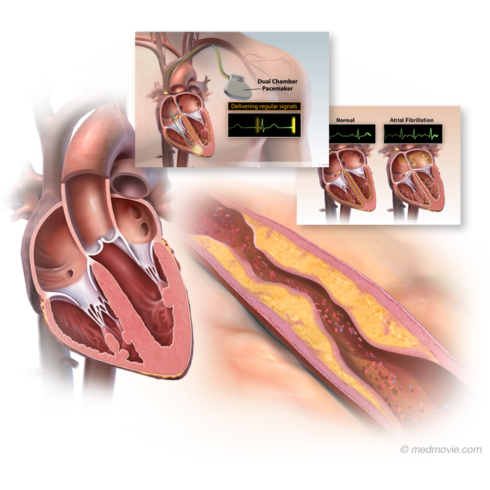 Heart Education Videos Baytown | Cardiology Teaching Houston