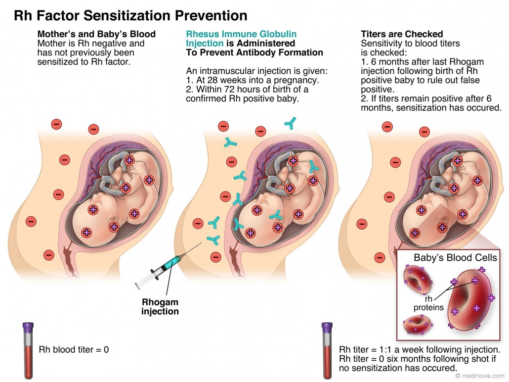 o positive mother and o negative father pregnancy