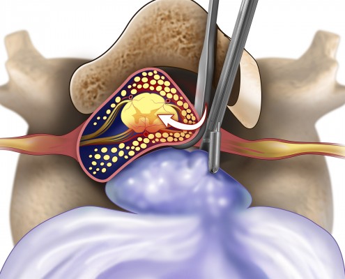 Custom Medical Trial Exhibits – Medmovie.com – Medmovie.com