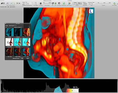 pc autoplay dicom viewer free for mac