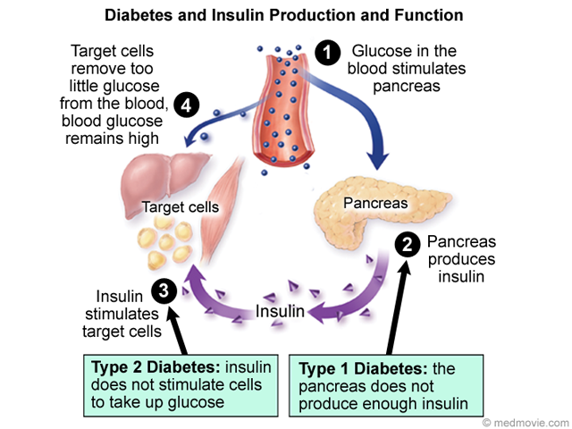 what gland secretes insulin
