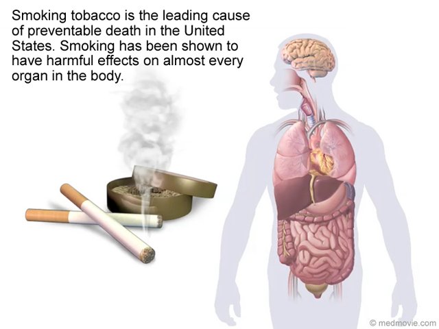 Smoking Effects on the Body