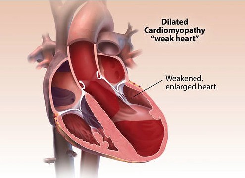 Cardiovascular Animations – Medmovie.com