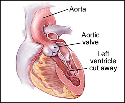 Aortic Valve