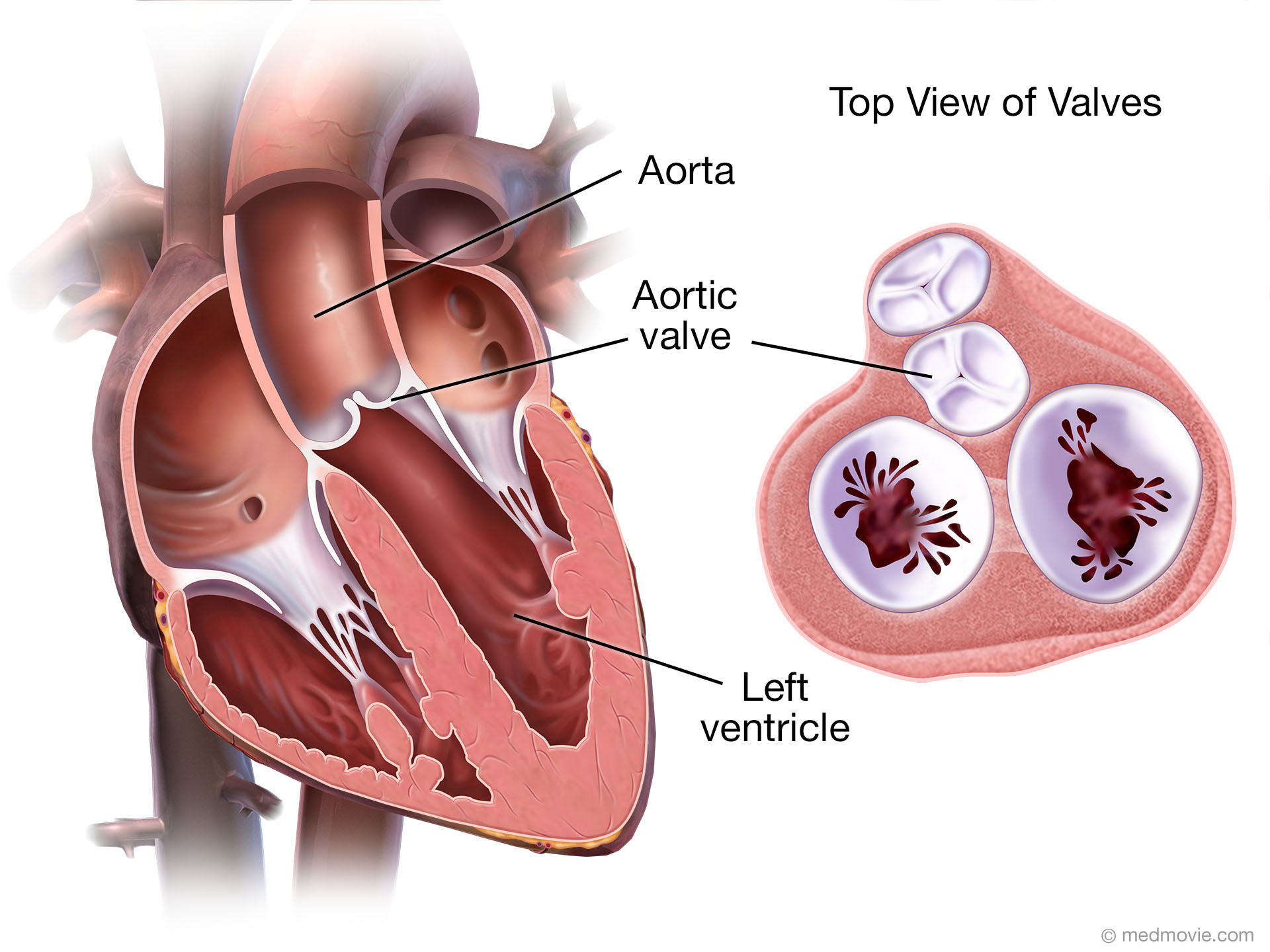 Diagram Of Aortic Valve