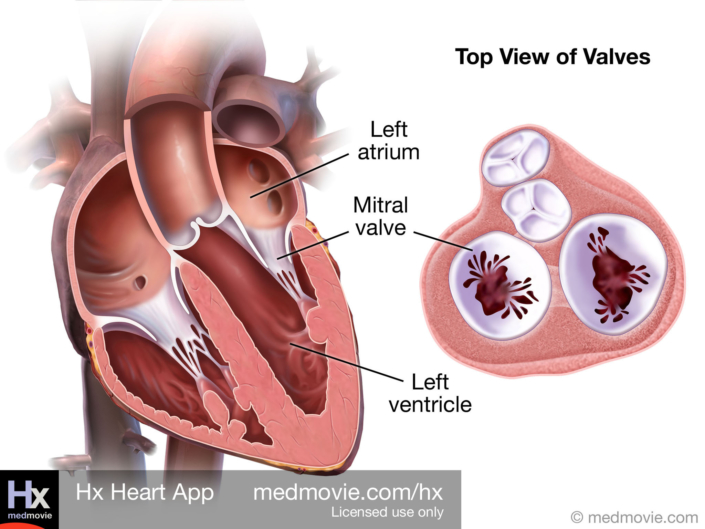 Mitral Valve