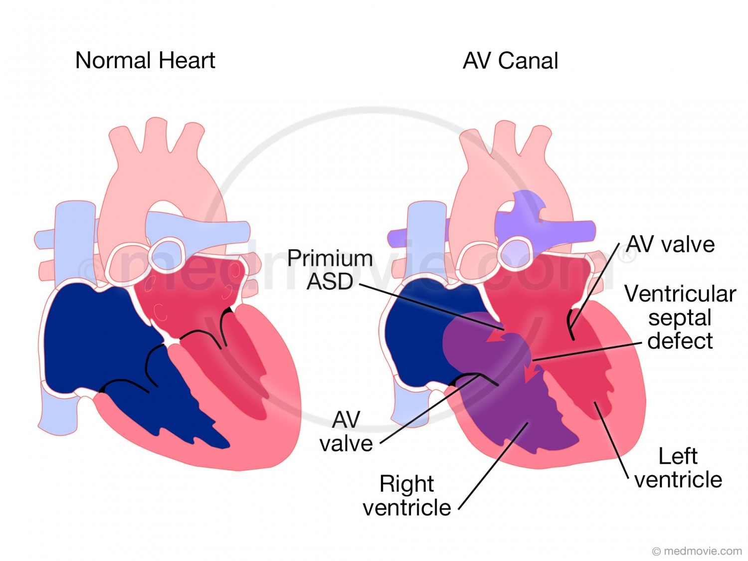 AV Canal – Medmovie.com