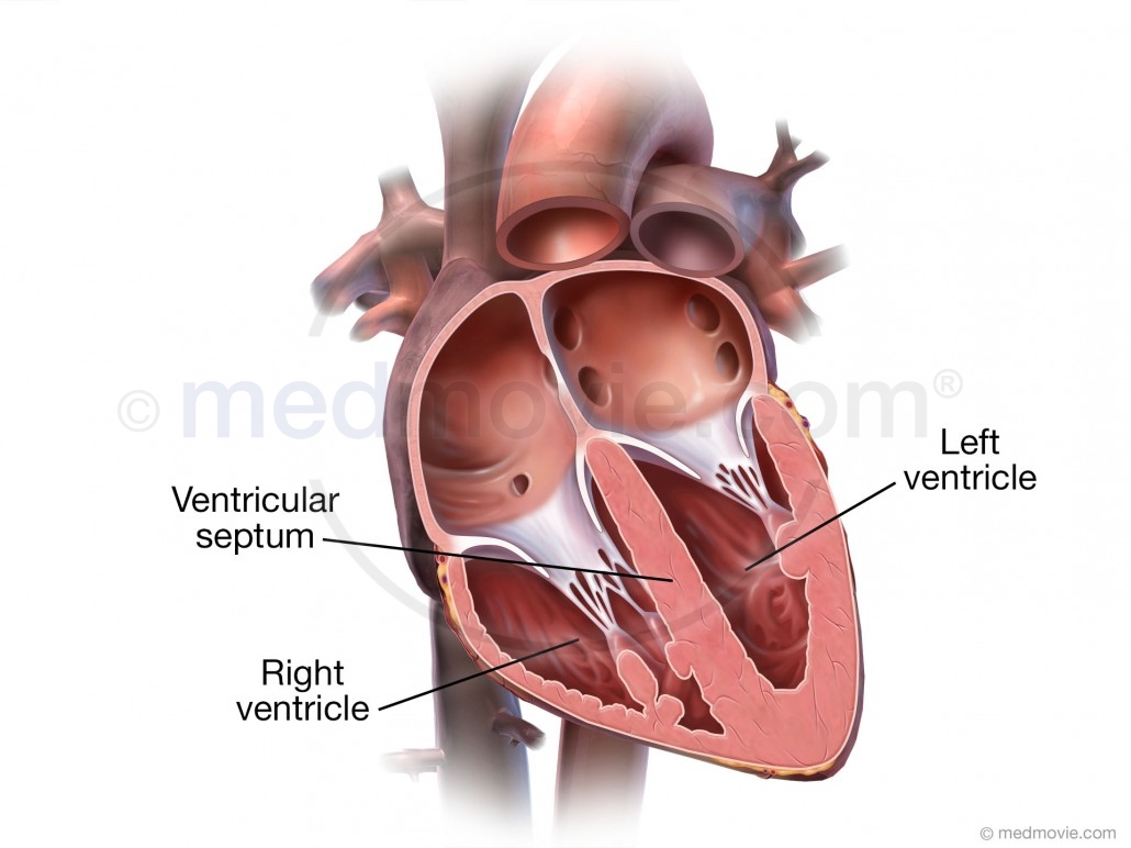 Ventricles