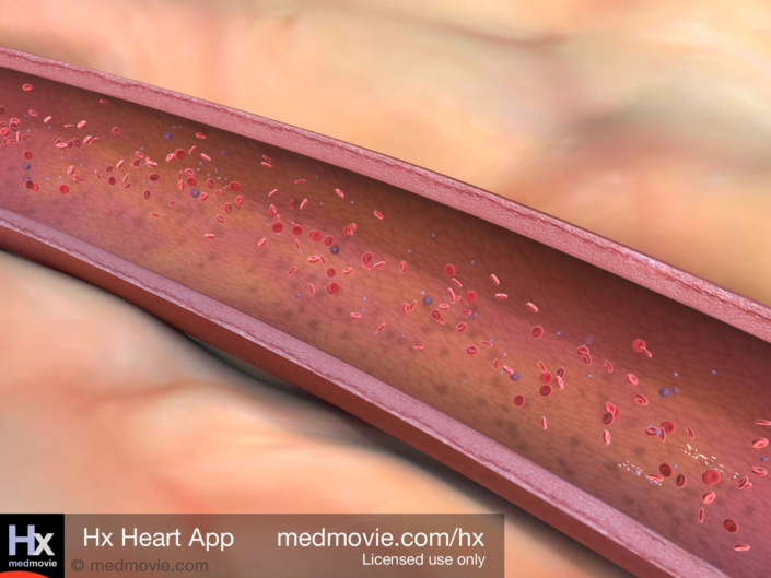 Normal Artery
