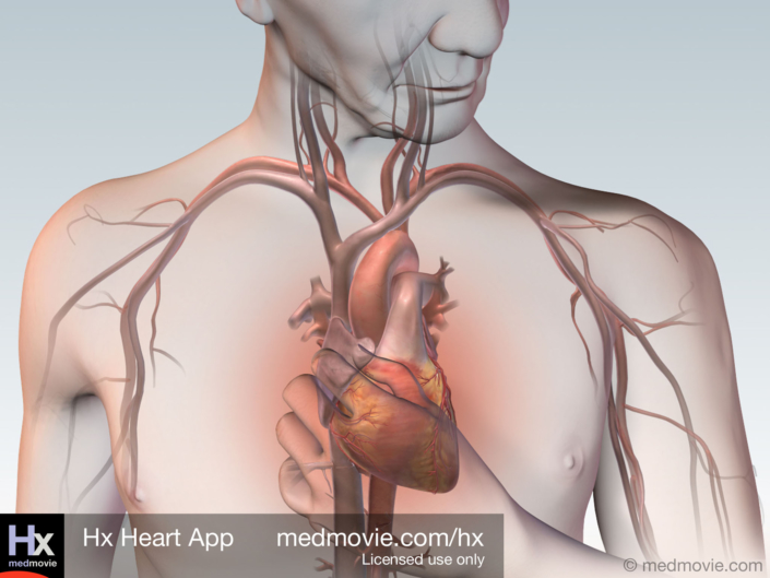 Coronary Artery Disease (Angina)
