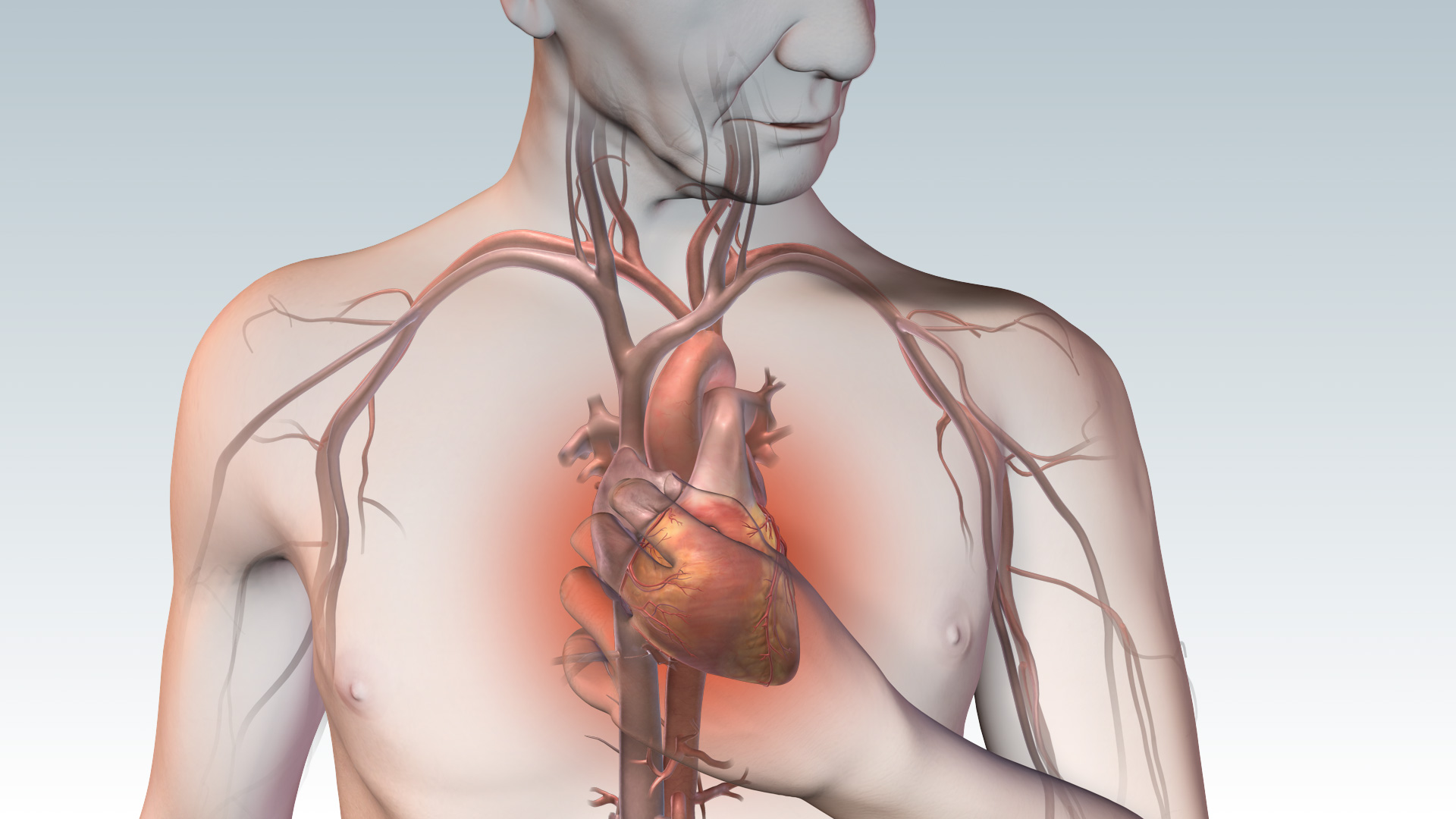 Coronary Artery Disease Other Names