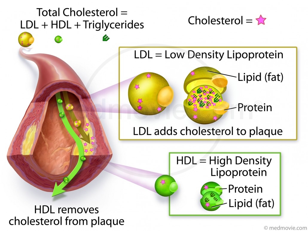 hdl vs ldl structure