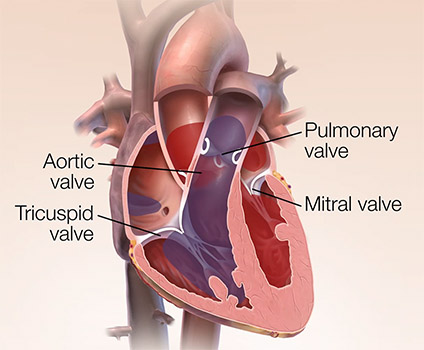 Heart Valve Surgery