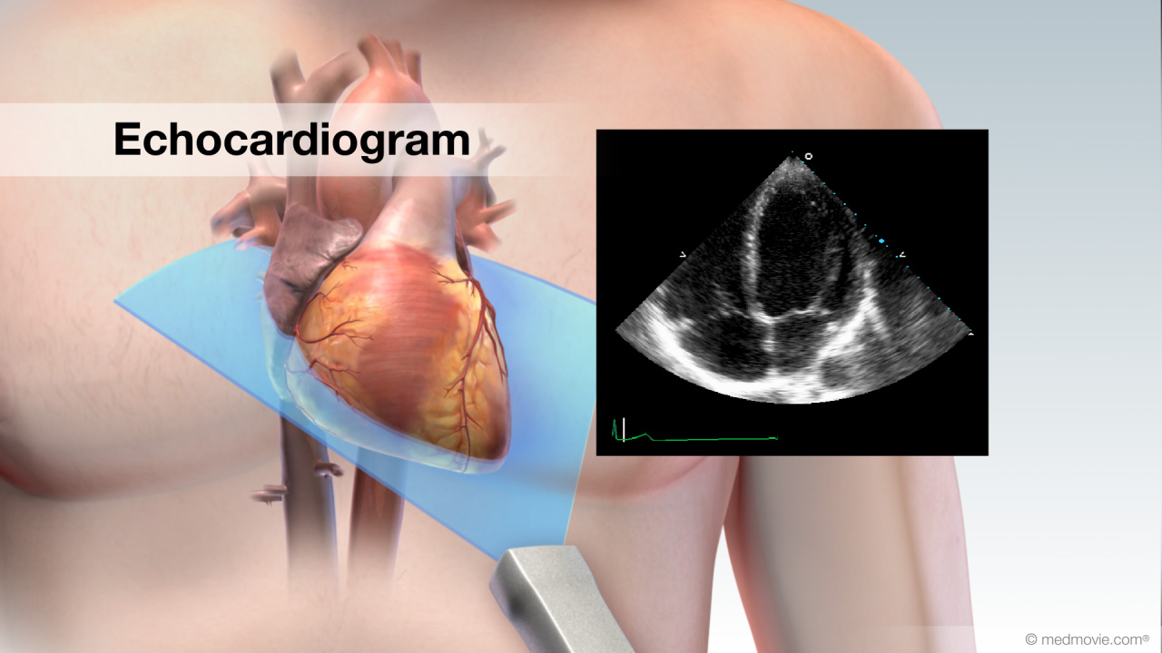 3d ultrasound of the heart