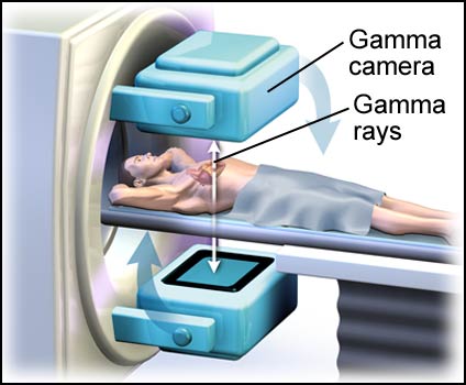 SPECT Scan