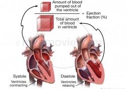 Ejection Fraction