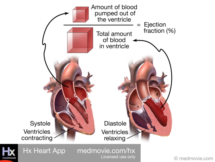 Ejection Fraction