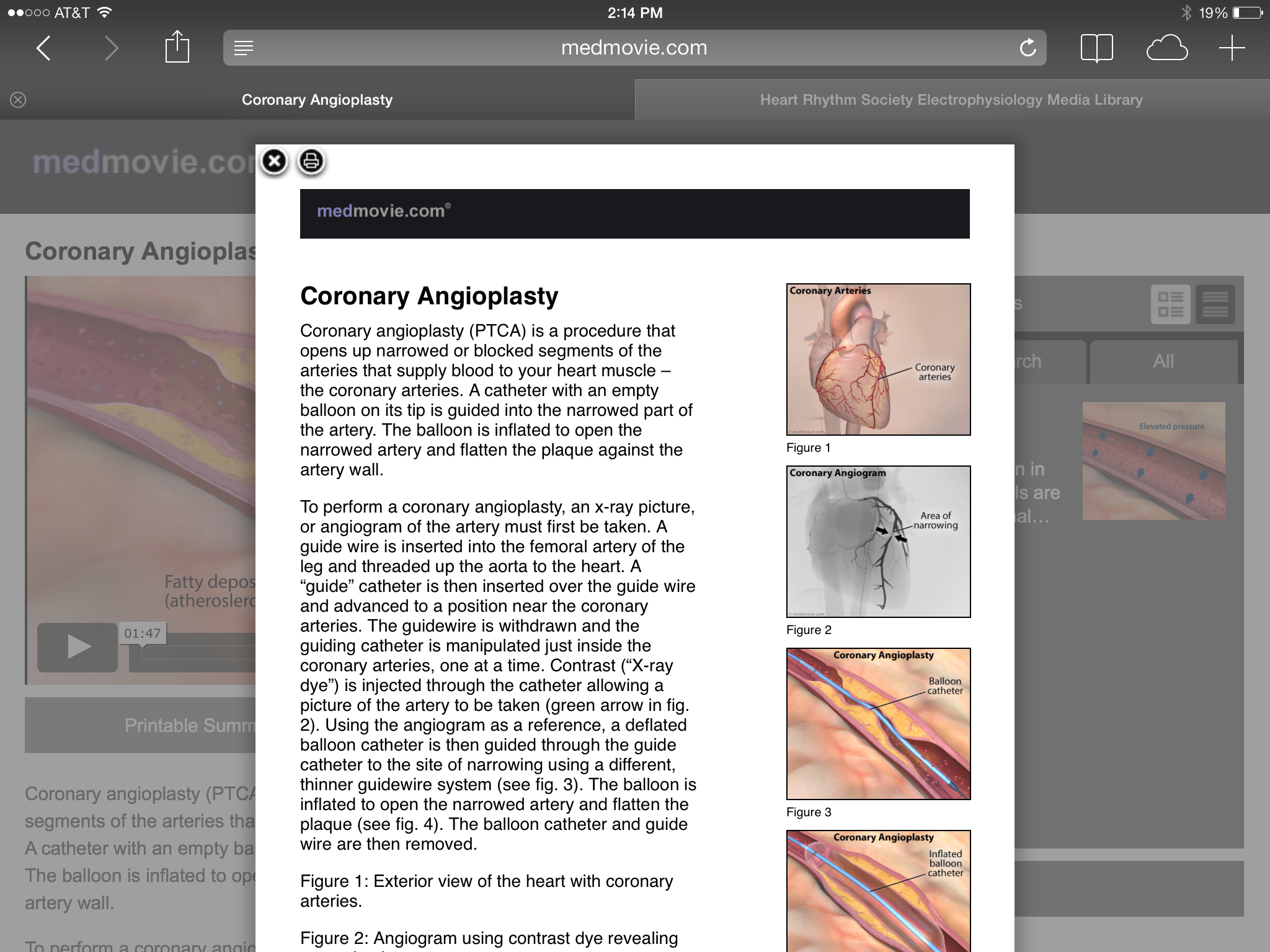 cvml_iPad_screenshot_02