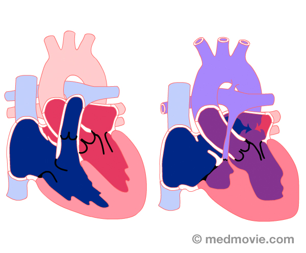 Heart Rhythm Society Electrophysiology Media Library