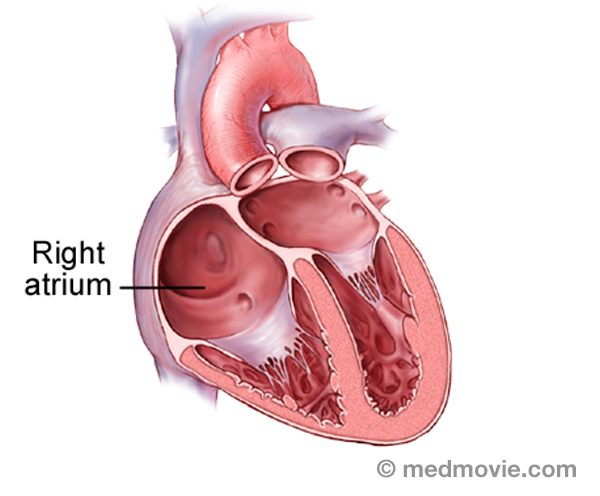 Right Atrium