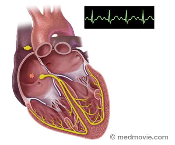 Heart Rhythm Society Electrophysiology Media Library