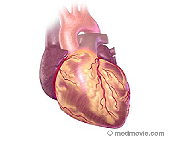 Common Heart Problems