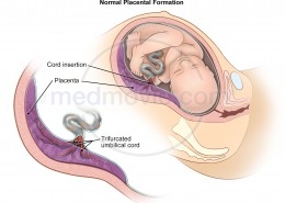 Normal Placenta