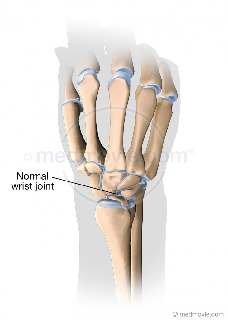 Normal Wrist Joint