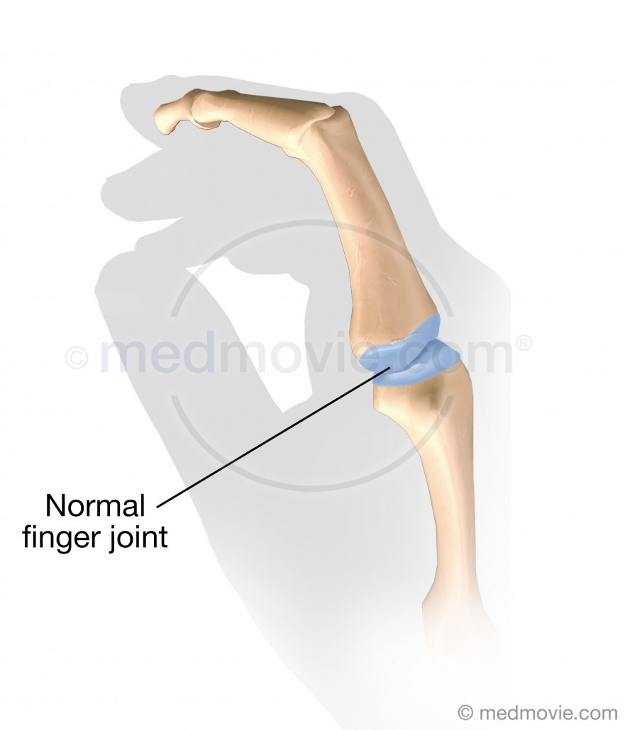 Normal Finger Joint