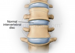 Normal Intervertebral Disc