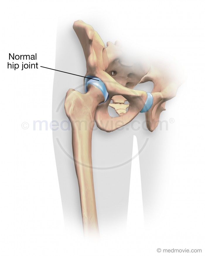 Normal Hip Joint