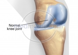 Normal Knee Joint