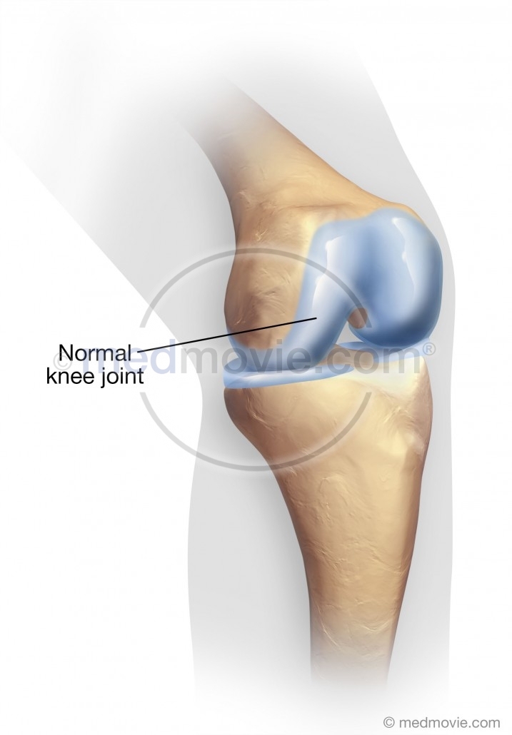 Normal Knee Joint