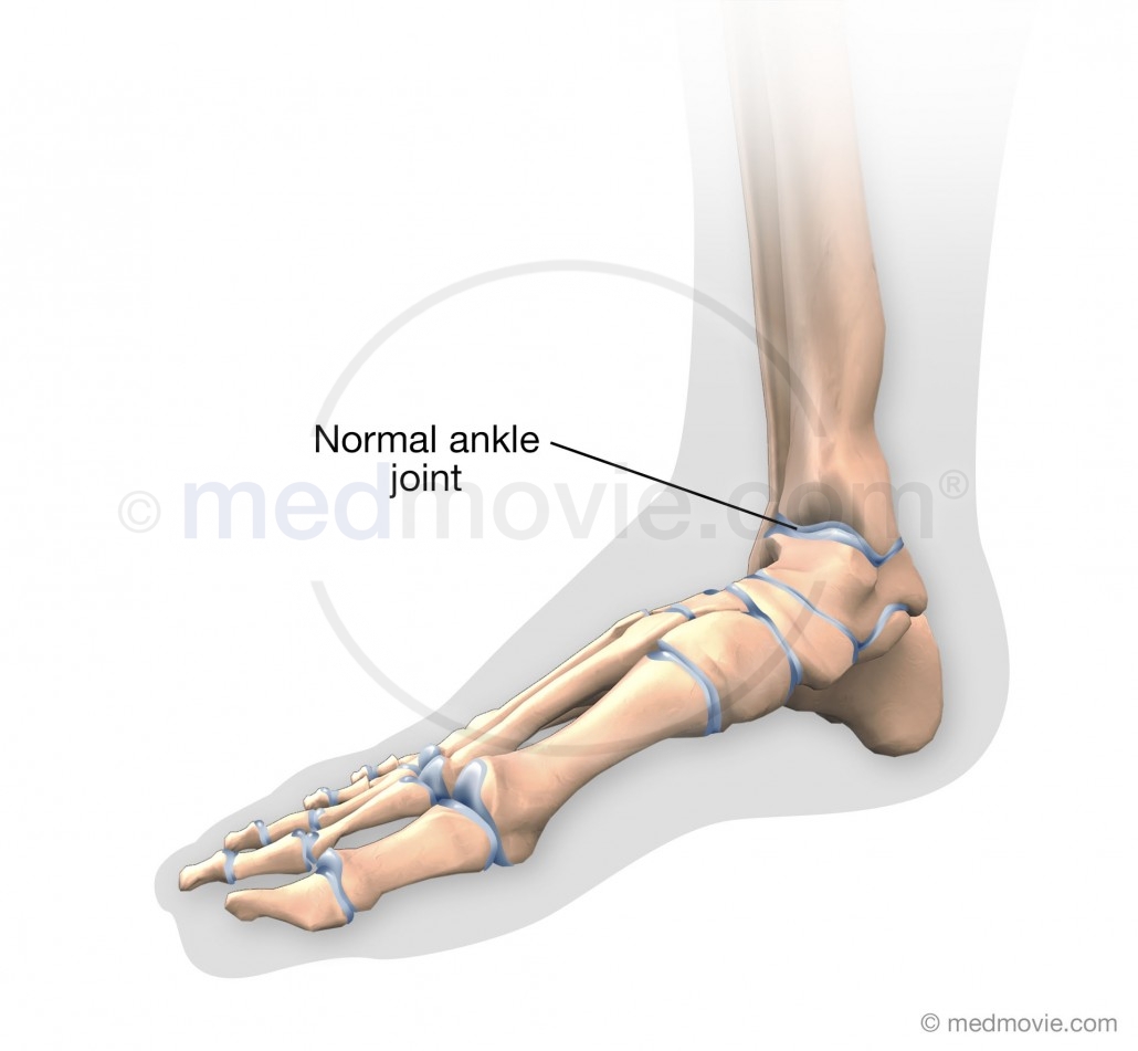 Normal Ankle Joint