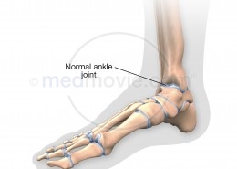 Normal Ankle Joint