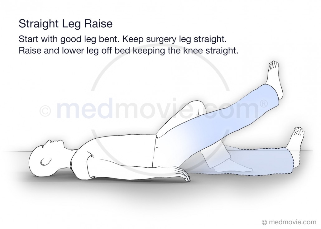 PT Straight Leg Raise