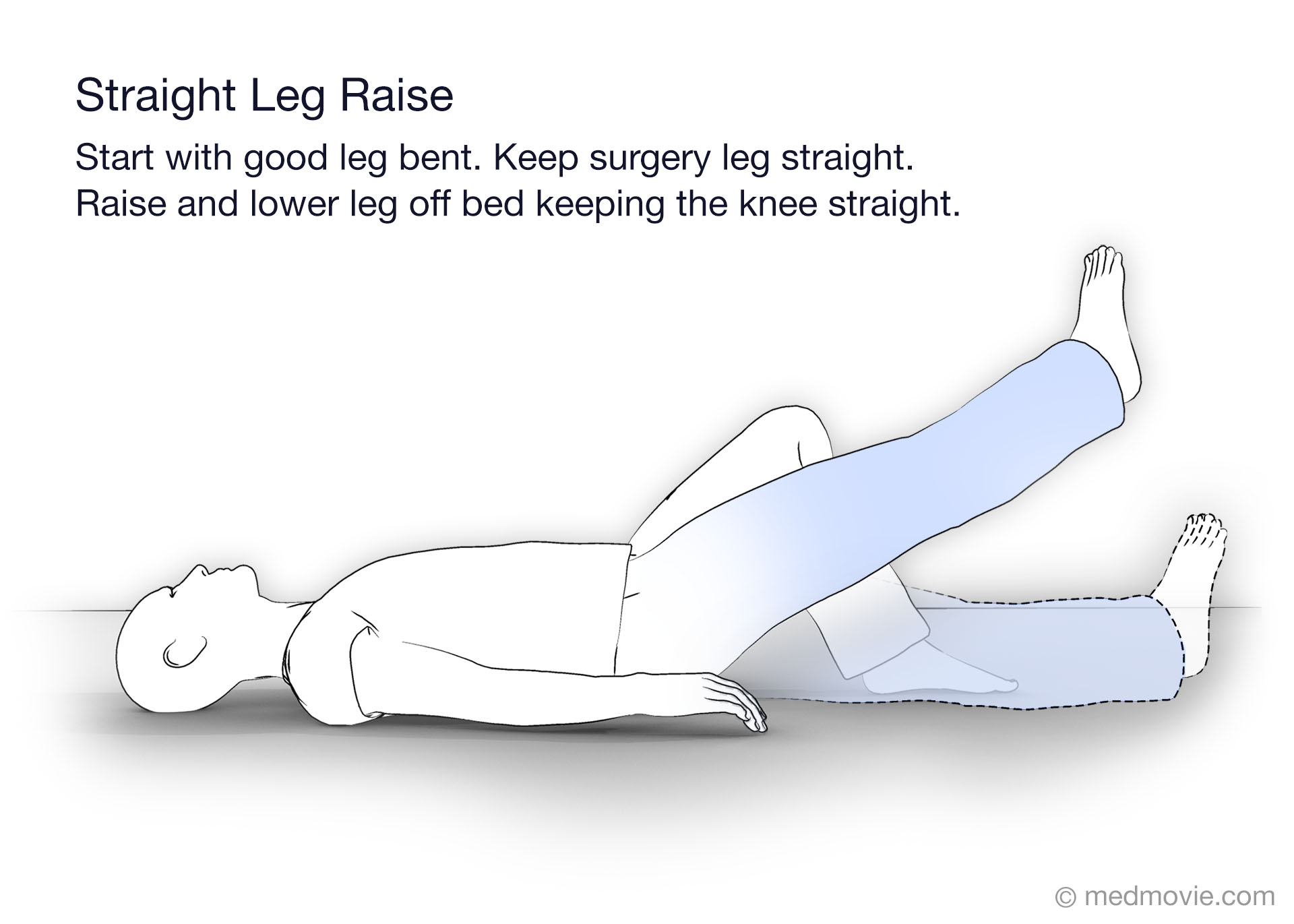 PT Straight Leg Raise – Medmovie.com