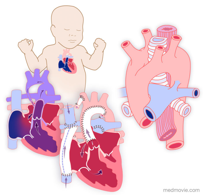 Pediatric Cardiology Media Library-VIDEO